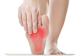 Plantar Fasciitis